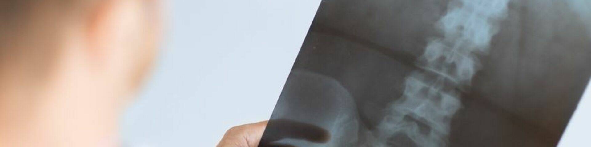 Table de radiologie